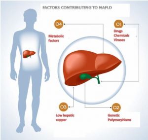 Non-alcoholic Fatty Liver Disease NAFLD & HTMA